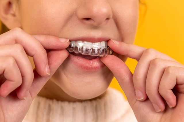 NICE SET OF TEETH